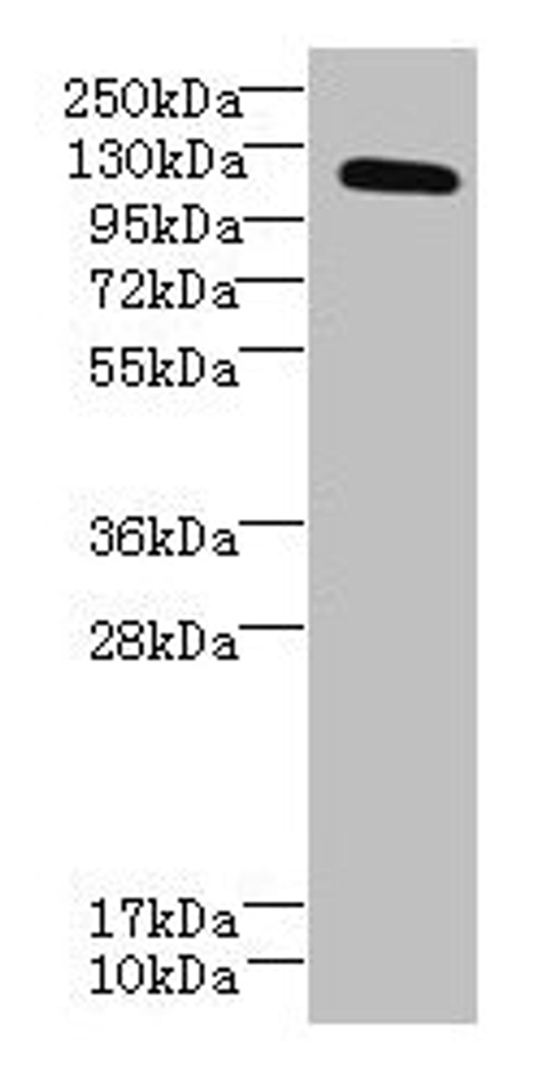 Western blot. All lanes: DIS3L antibody at 6µg/ml + MCF-7 whole cell lysate. Secondary. Goat polyclonal to rabbit IgG at 1/10000 dilution. Predicted band size: 121, 106, 87, 112 kDa. Observed band size: 121 kDa