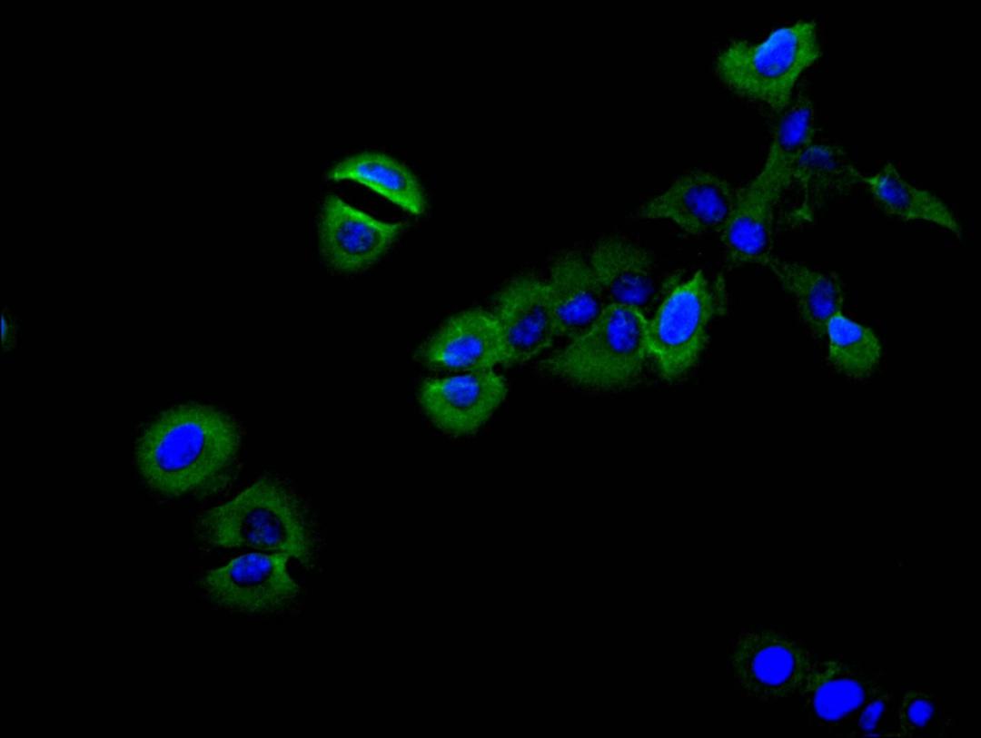 Immunofluorescence staining of SH-SY5Y cell with CSB-RA013714MA1HU at 1:30,  counter-stained with DAPI. The cells were fixed in 4% formaldehyde and blocked in 10% normal Goat Serum. The cells were then incubated with the antibody overnight at 4C. The secondary antibody was FITC-conjugated AffiniPure Goat Anti-Mouse IgG(H+L).
