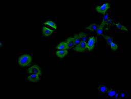 Immunofluorescence staining of SH-SY5Y cell with CSB-RA013714MA1HU at 1:30,  counter-stained with DAPI. The cells were fixed in 4% formaldehyde and blocked in 10% normal Goat Serum. The cells were then incubated with the antibody overnight at 4C. The secondary antibody was FITC-conjugated AffiniPure Goat Anti-Mouse IgG(H+L).