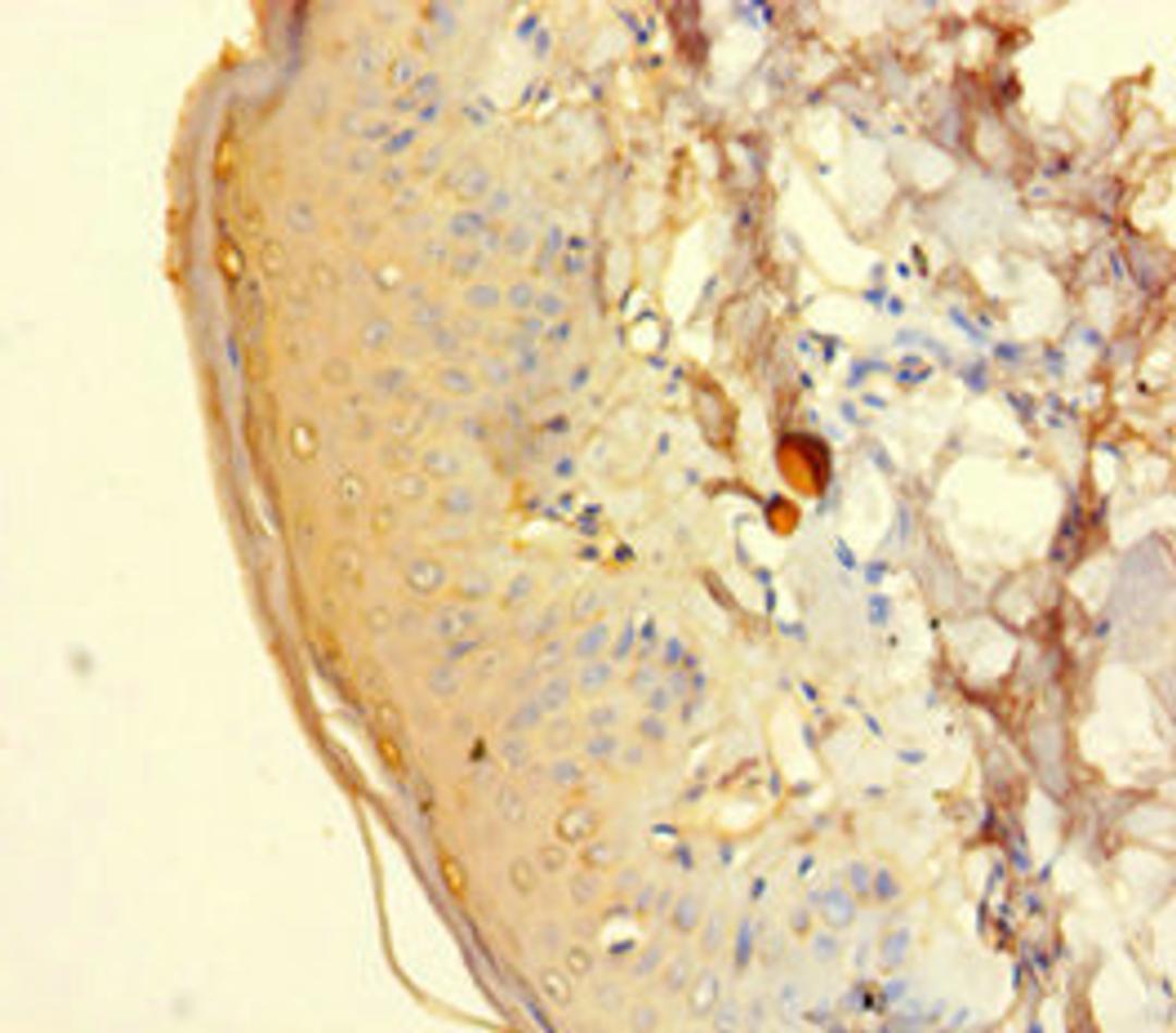 Immunohistochemistry of paraffin-embedded human adrenal gland tissue using CSB-PA010887LA01HU at dilution of 1:100