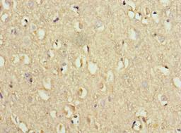 Immunohistochemistry of paraffin-embedded human brain tissue using CSB-PA845154HA01HU at dilution of 1:100