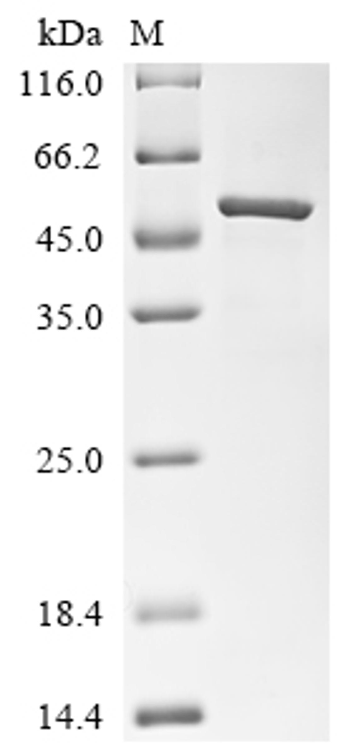 (Tris-Glycine gel) Discontinuous SDS-PAGE (reduced) with 5% enrichment gel and 15% separation gel.