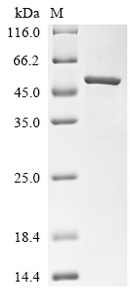 (Tris-Glycine gel) Discontinuous SDS-PAGE (reduced) with 5% enrichment gel and 15% separation gel.