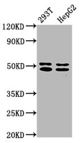 Western Blot. Positive WB detected in: 293T whole cell lysate, HepG2 whole cell lysate. All lanes: TRNT1 antibody at 5ug/ml. Secondary. Goat polyclonal to rabbit IgG at 1/50000 dilution. Predicted band size: 51, 48, 7 kDa. Observed band size: 51, 48 kDa. 
