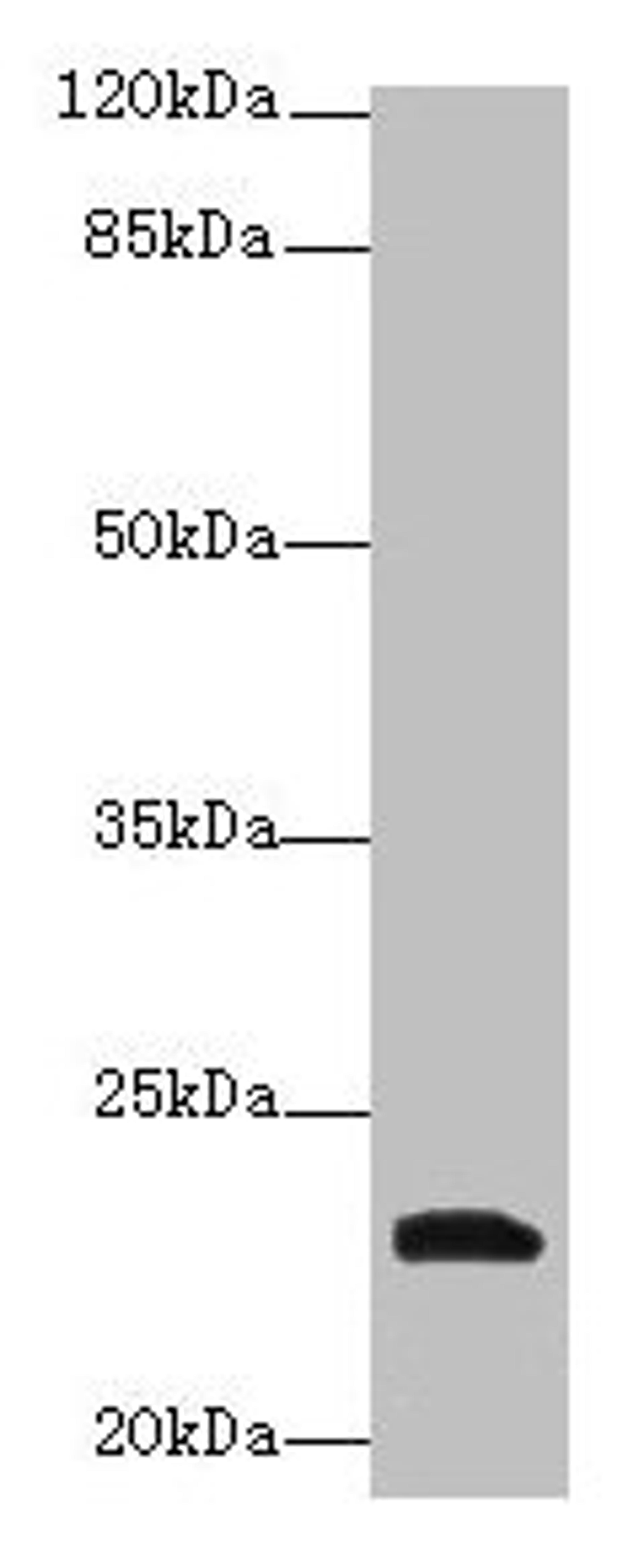 Western blot. All lanes: YKT6 antibody at 12µg/ml + A549 whole cell lysate. Secondary. Goat polyclonal to rabbit IgG at 1/10000 dilution. Predicted band size: 23, 19 kDa. Observed band size: 23 kDa