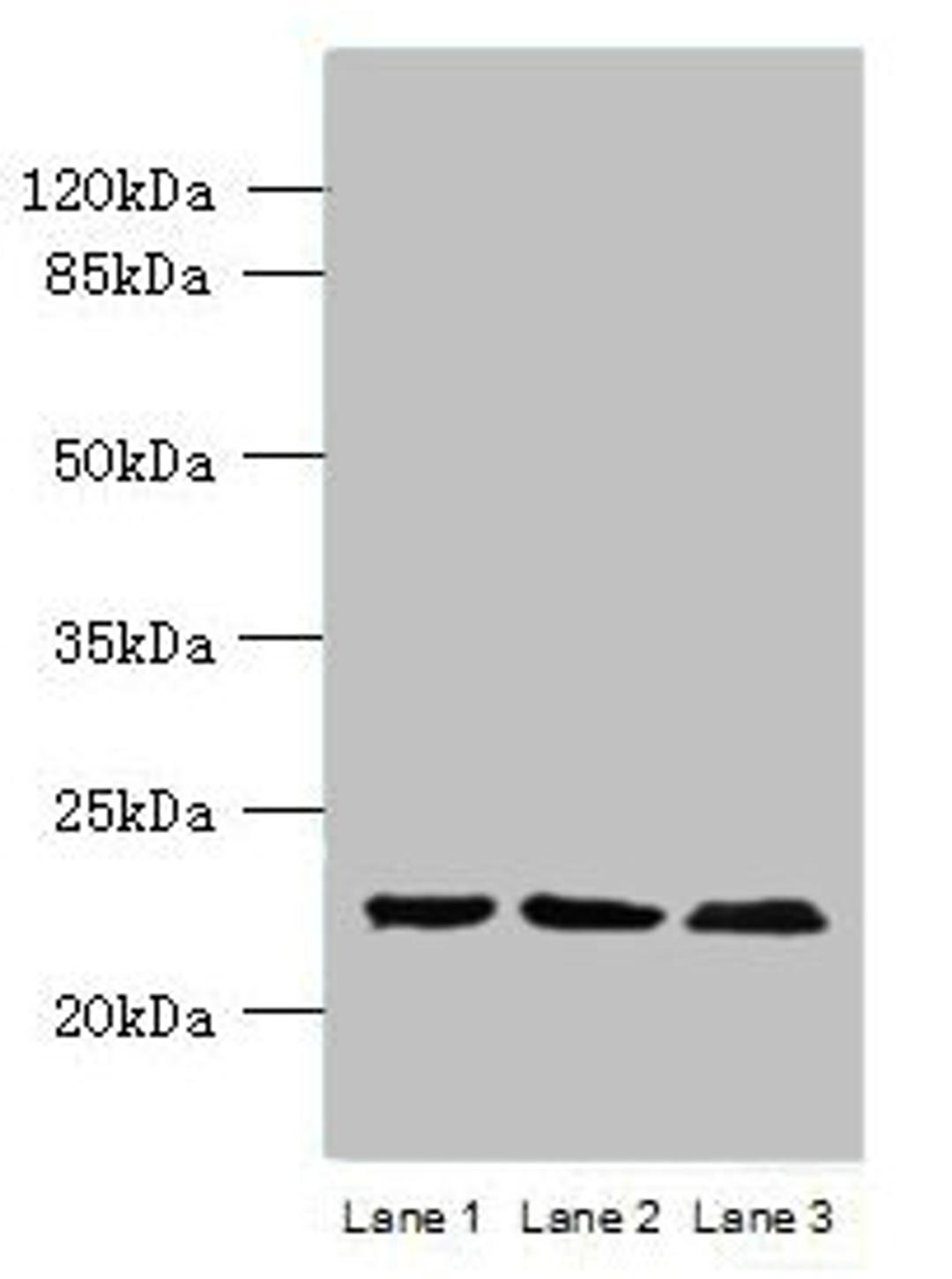 Western blot. All lanes: WDYHV1 antibody at 6ug/ml. Lane 1: Mouse heart tissue. Lane 2: MCF-7 whole cell lysate. Lane 3: U251 whole cell lysate. Secondary. Goat polyclonal to Rabbit IgG at 1/10000 dilution. Predicted band size: 24, 17 kDa. Observed band size: 24 kDa. 