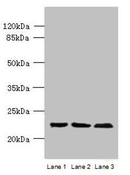 Western blot. All lanes: WDYHV1 antibody at 6ug/ml. Lane 1: Mouse heart tissue. Lane 2: MCF-7 whole cell lysate. Lane 3: U251 whole cell lysate. Secondary. Goat polyclonal to Rabbit IgG at 1/10000 dilution. Predicted band size: 24, 17 kDa. Observed band size: 24 kDa. 