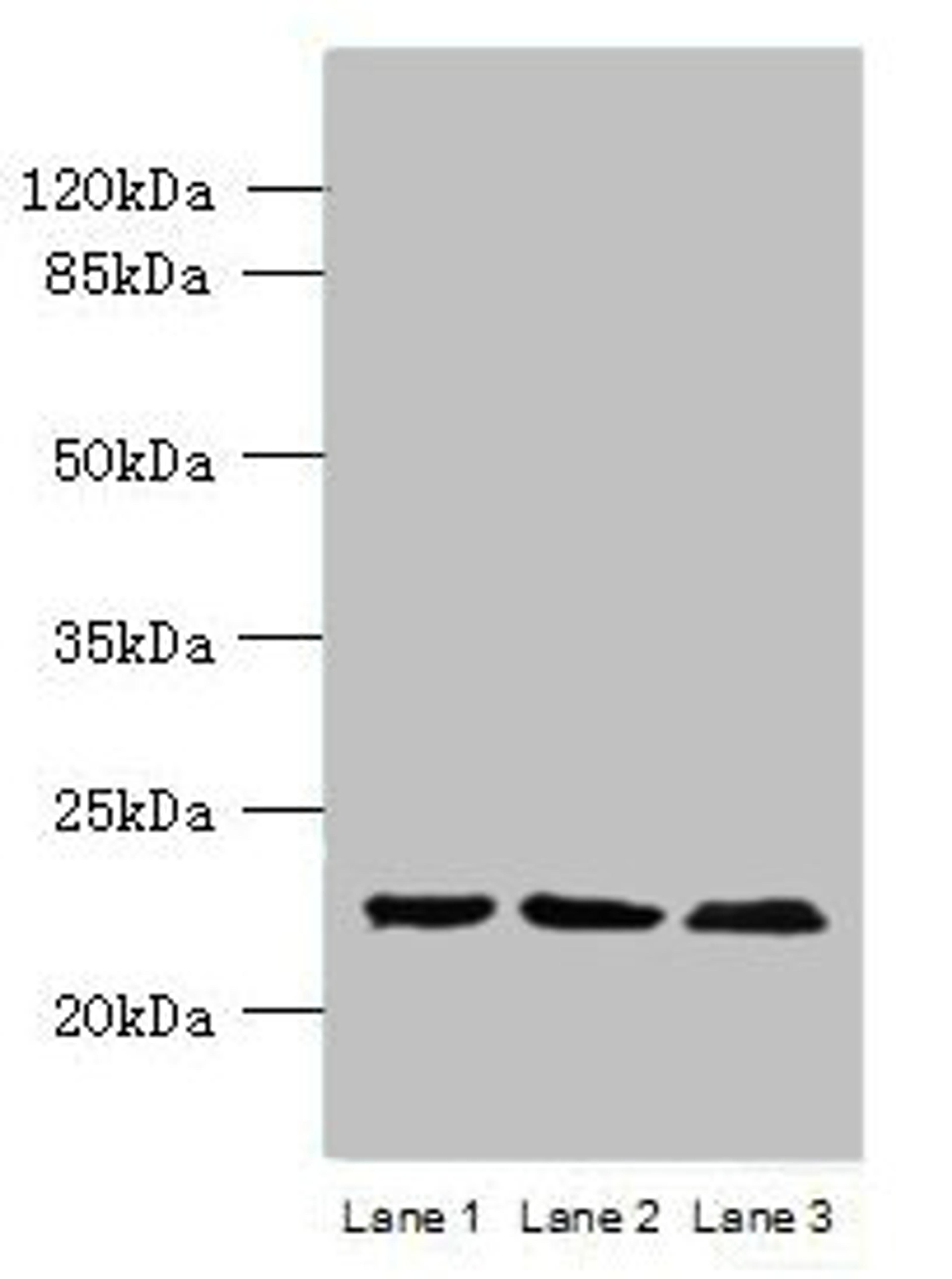 Western blot. All lanes: WDYHV1 antibody at 6ug/ml. Lane 1: Mouse heart tissue. Lane 2: MCF-7 whole cell lysate. Lane 3: U251 whole cell lysate. Secondary. Goat polyclonal to Rabbit IgG at 1/10000 dilution. Predicted band size: 24, 17 kDa. Observed band size: 24 kDa. 