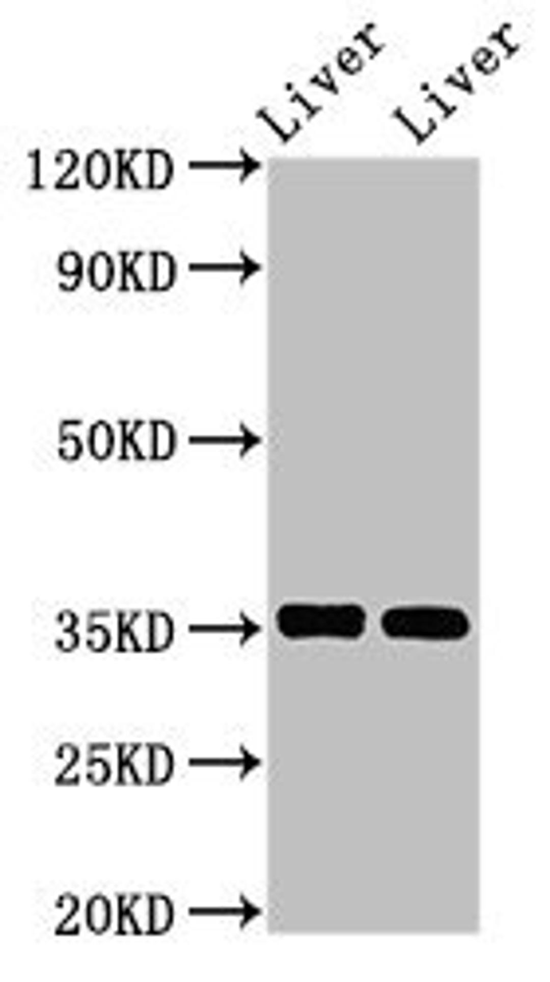 Western Blot. Positive WB detected in: Mouse liver tissue, Rat liver tissue. All lanes: ARG1 antibody at 2.8µg/ml. Secondary. Goat polyclonal to rabbit IgG at 1/50000 dilution. Predicted band size: 35, 36, 26 kDa. Observed band size: 35 kDa
