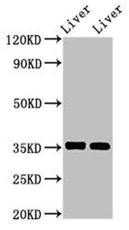 Western Blot. Positive WB detected in: Mouse liver tissue, Rat liver tissue. All lanes: ARG1 antibody at 2.8µg/ml. Secondary. Goat polyclonal to rabbit IgG at 1/50000 dilution. Predicted band size: 35, 36, 26 kDa. Observed band size: 35 kDa