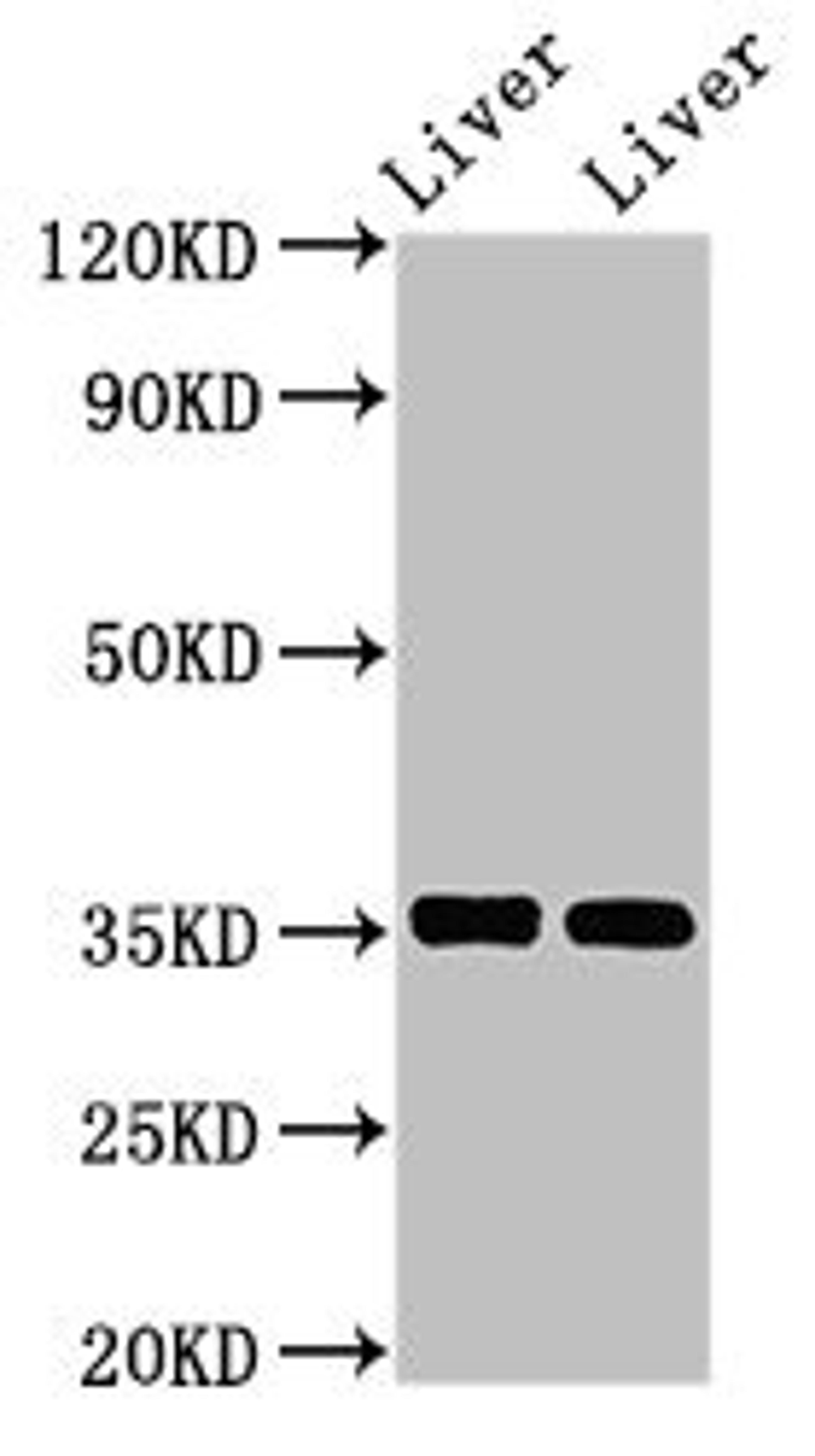 Western Blot. Positive WB detected in: Mouse liver tissue, Rat liver tissue. All lanes: ARG1 antibody at 2.8µg/ml. Secondary. Goat polyclonal to rabbit IgG at 1/50000 dilution. Predicted band size: 35, 36, 26 kDa. Observed band size: 35 kDa