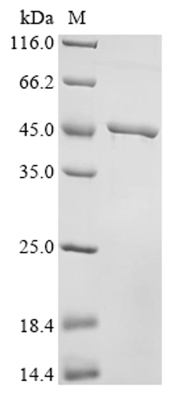 (Tris-Glycine gel) Discontinuous SDS-PAGE (reduced) with 5% enrichment gel and 15% separation gel.