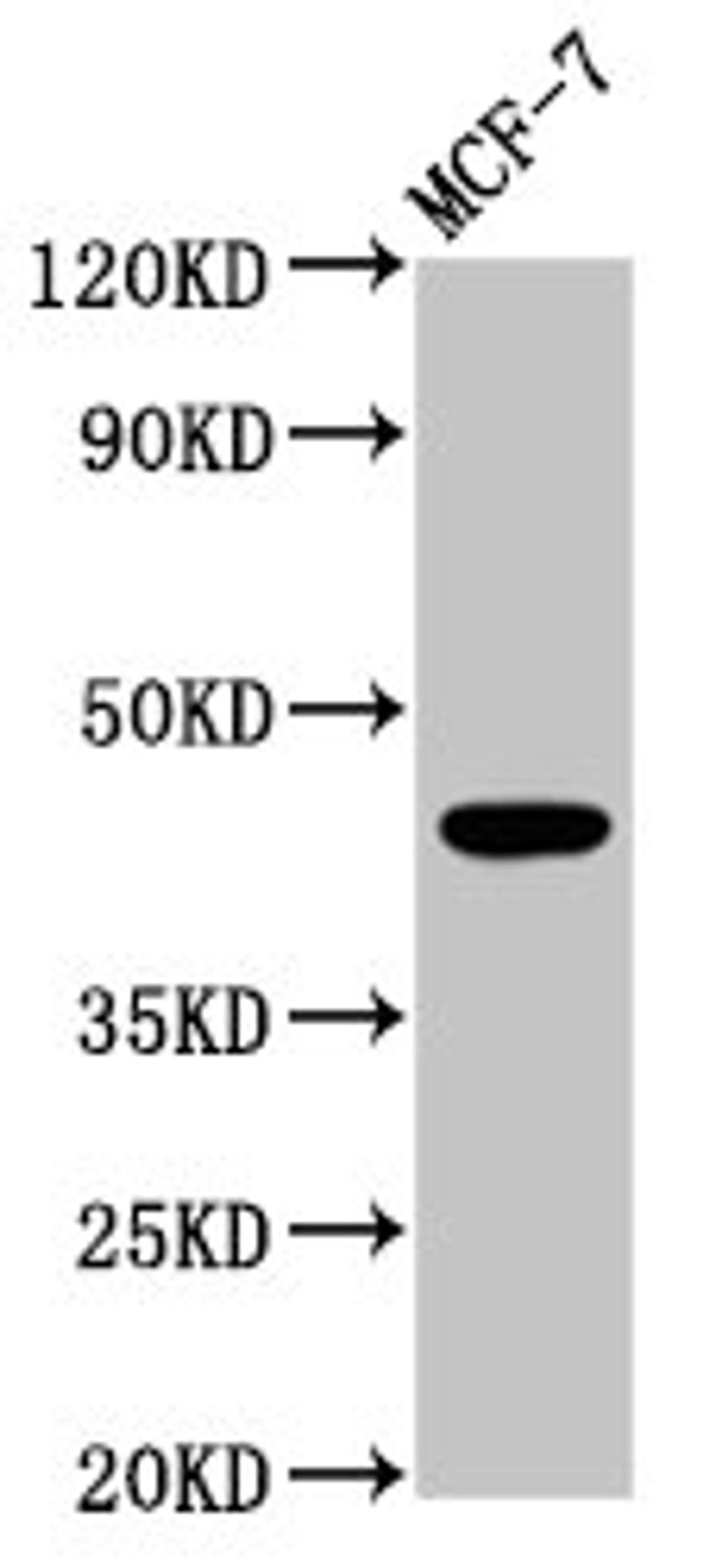Western Blot. Positive WB detected in: MCF-7 whole cell lysate. All lanes: BDKRB2 antibody at 4.2µg/ml. Secondary. Goat polyclonal to rabbit IgG at 1/50000 dilution. Predicted band size: 45, 42 kDa. Observed band size: 45 kDa