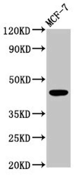 Western Blot. Positive WB detected in: MCF-7 whole cell lysate. All lanes: BDKRB2 antibody at 4.2µg/ml. Secondary. Goat polyclonal to rabbit IgG at 1/50000 dilution. Predicted band size: 45, 42 kDa. Observed band size: 45 kDa