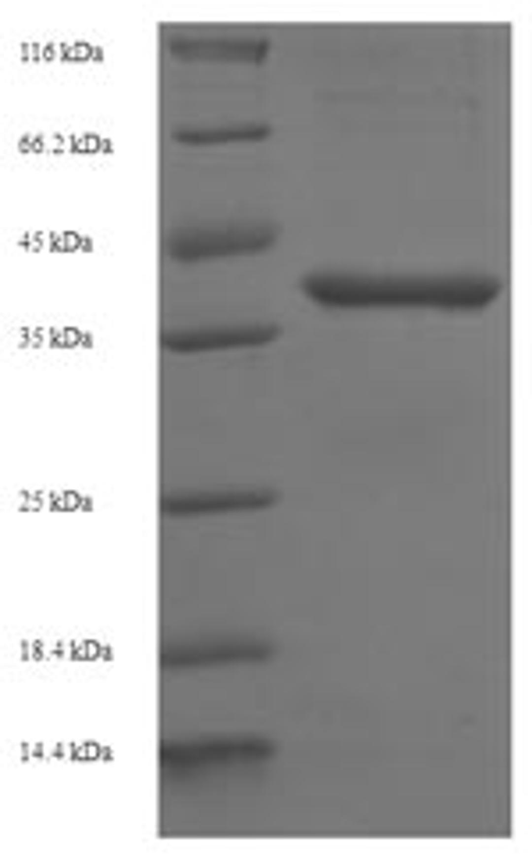 (Tris-Glycine gel) Discontinuous SDS-PAGE (reduced) with 5% enrichment gel and 15% separation gel.