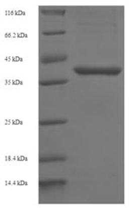 (Tris-Glycine gel) Discontinuous SDS-PAGE (reduced) with 5% enrichment gel and 15% separation gel.