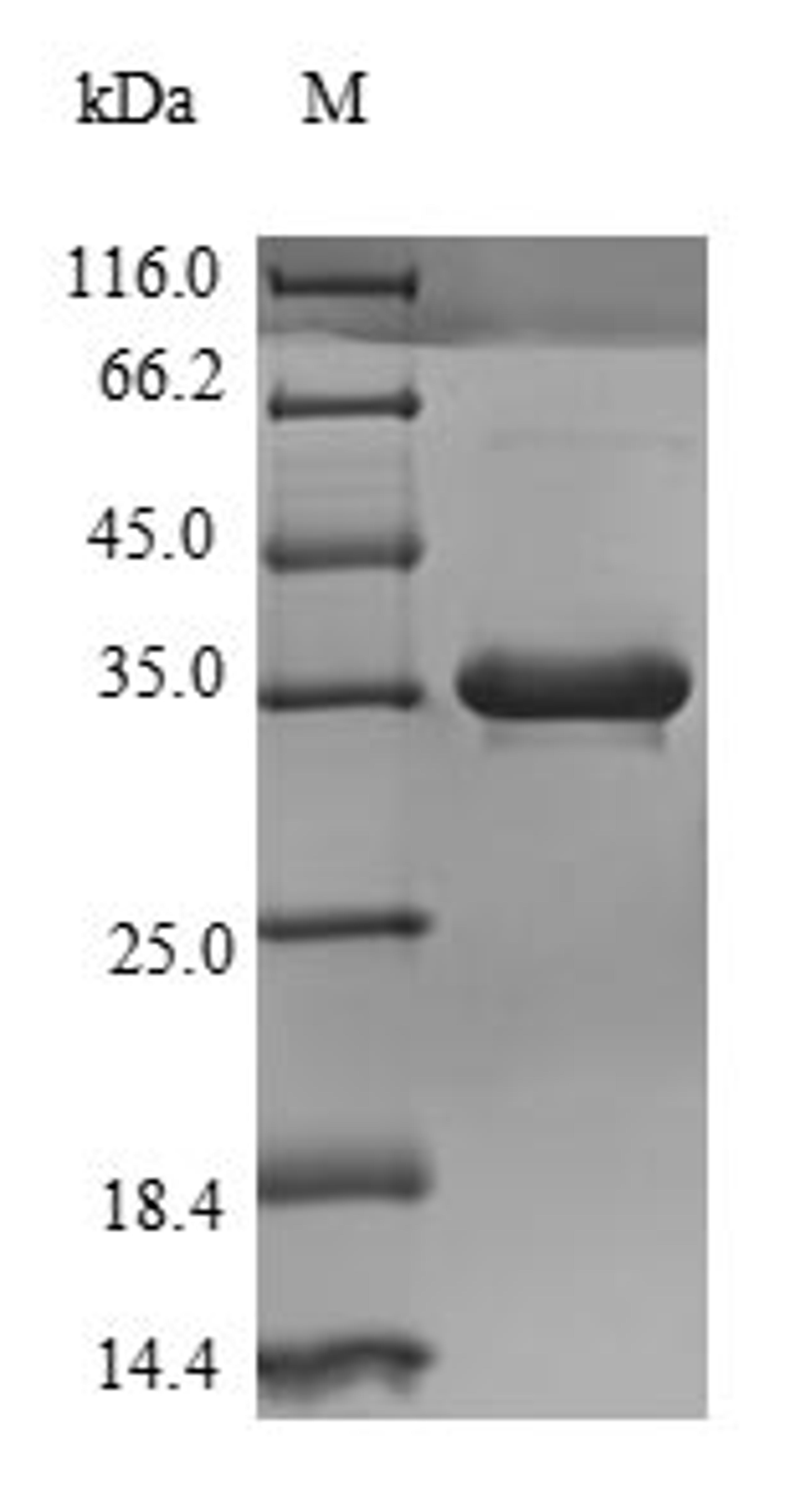 (Tris-Glycine gel) Discontinuous SDS-PAGE (reduced) with 5% enrichment gel and 15% separation gel.