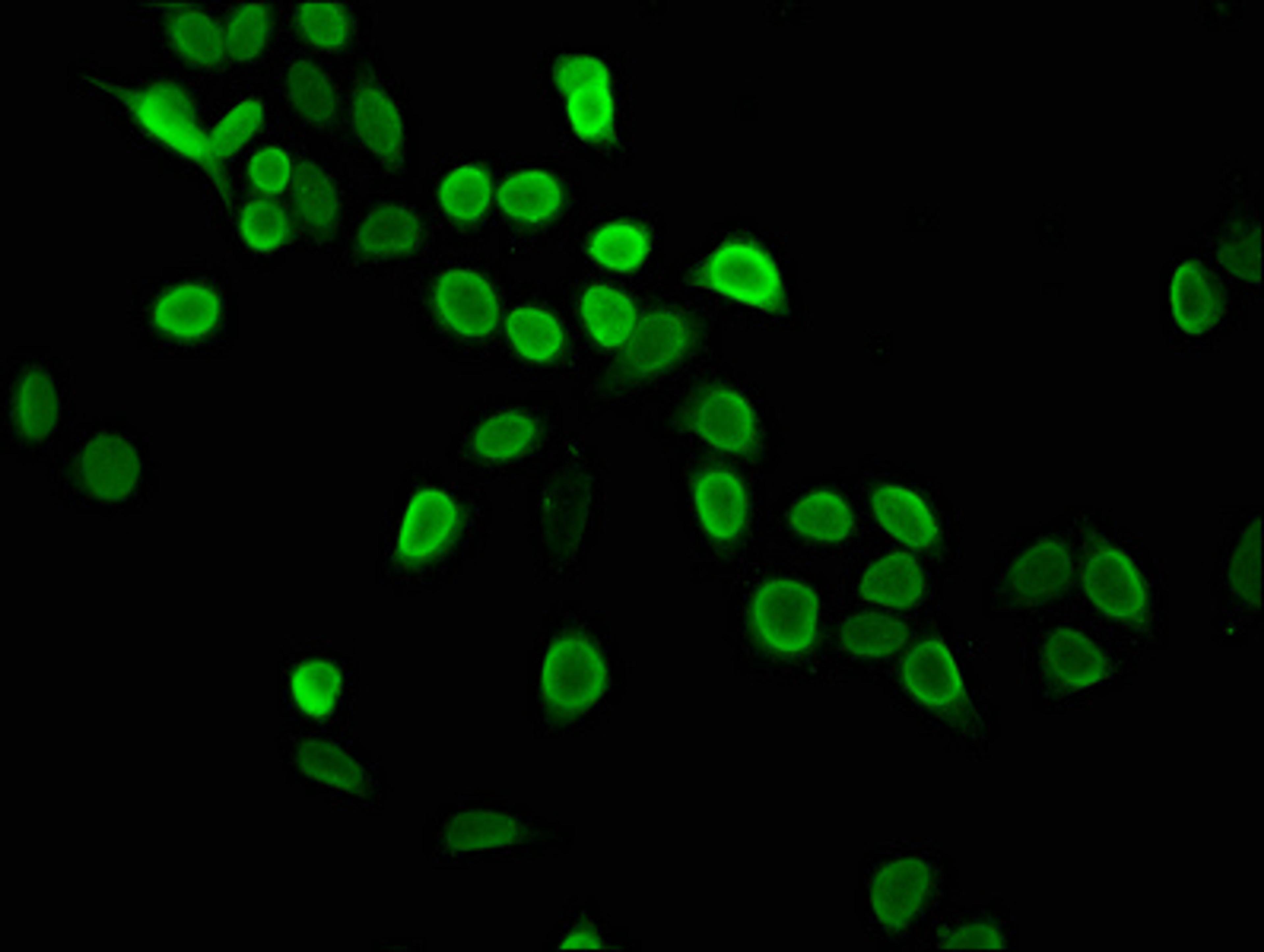 Immunofluorescence staining of Hela cells with CSB-PA010429OA05me1HU at 1:2.5, counter-stained with DAPI. The cells were fixed in 4% formaldehyde, permeabilized using 0.2% Triton X-100 and blocked in 10% normal Goat Serum. The cells were then incubated with the antibody overnight at 4&deg;C. The secondary antibody was Alexa Fluor 488-congugated AffiniPure Goat Anti-Rabbit IgG(H+L).