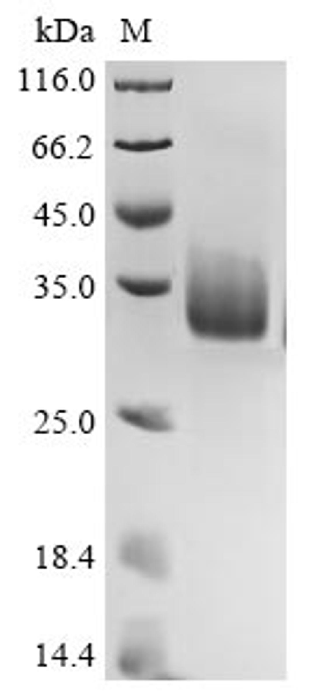(Tris-Glycine gel) Discontinuous SDS-PAGE (reduced) with 5% enrichment gel and 15% separation gel.