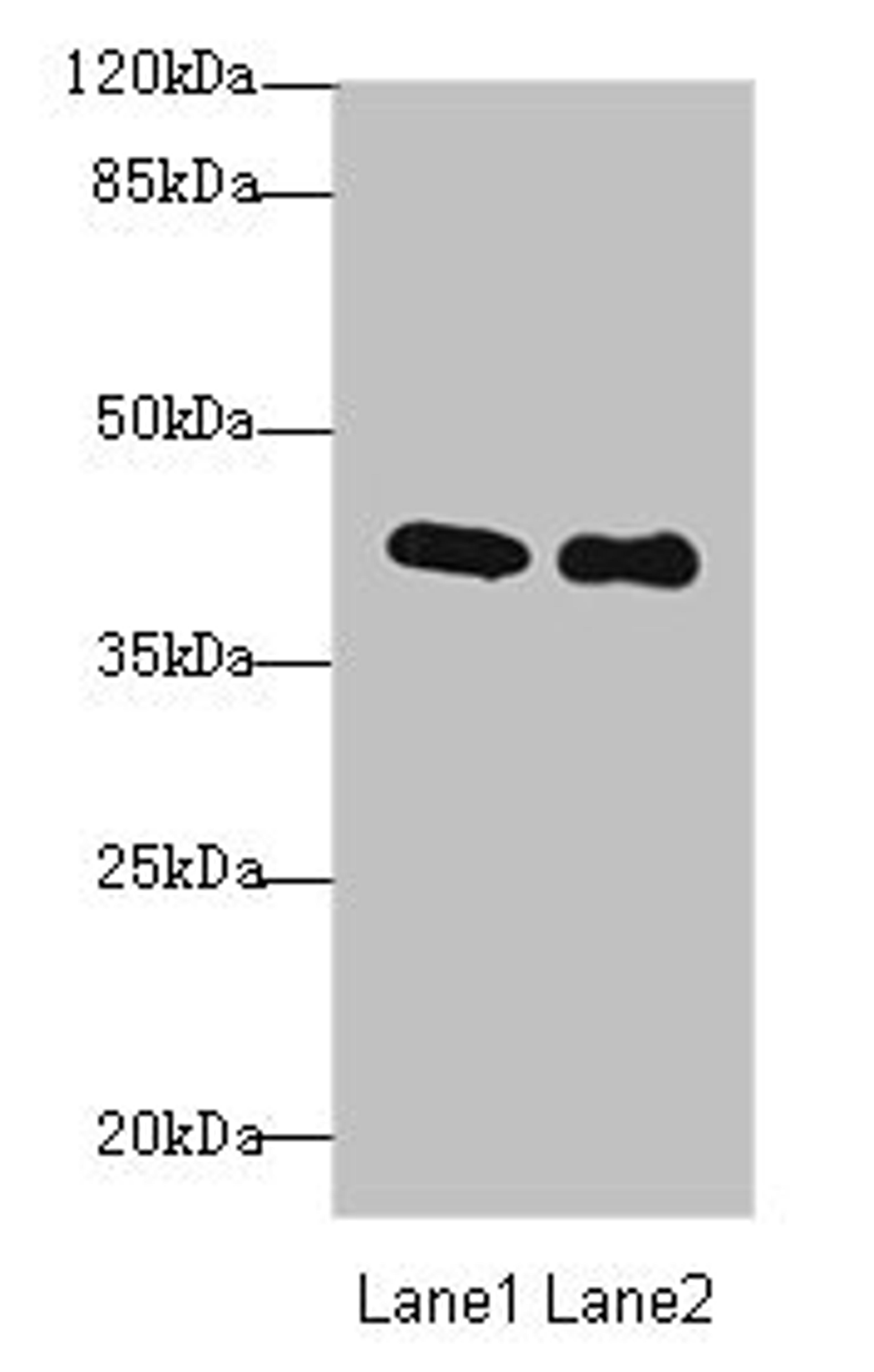 Western blot. All lanes: P2RY13 antibody at 3µg/ml. Lane 1: HT29 whole cell lysate. Lane 2: Colo320 whole cell lysate. Secondary. Goat polyclonal to rabbit IgG at 1/10000 dilution. Predicted band size: 41, 39 kDa. Observed band size: 41 kDa