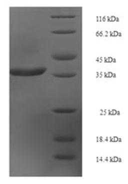 (Tris-Glycine gel) Discontinuous SDS-PAGE (reduced) with 5% enrichment gel and 15% separation gel.
