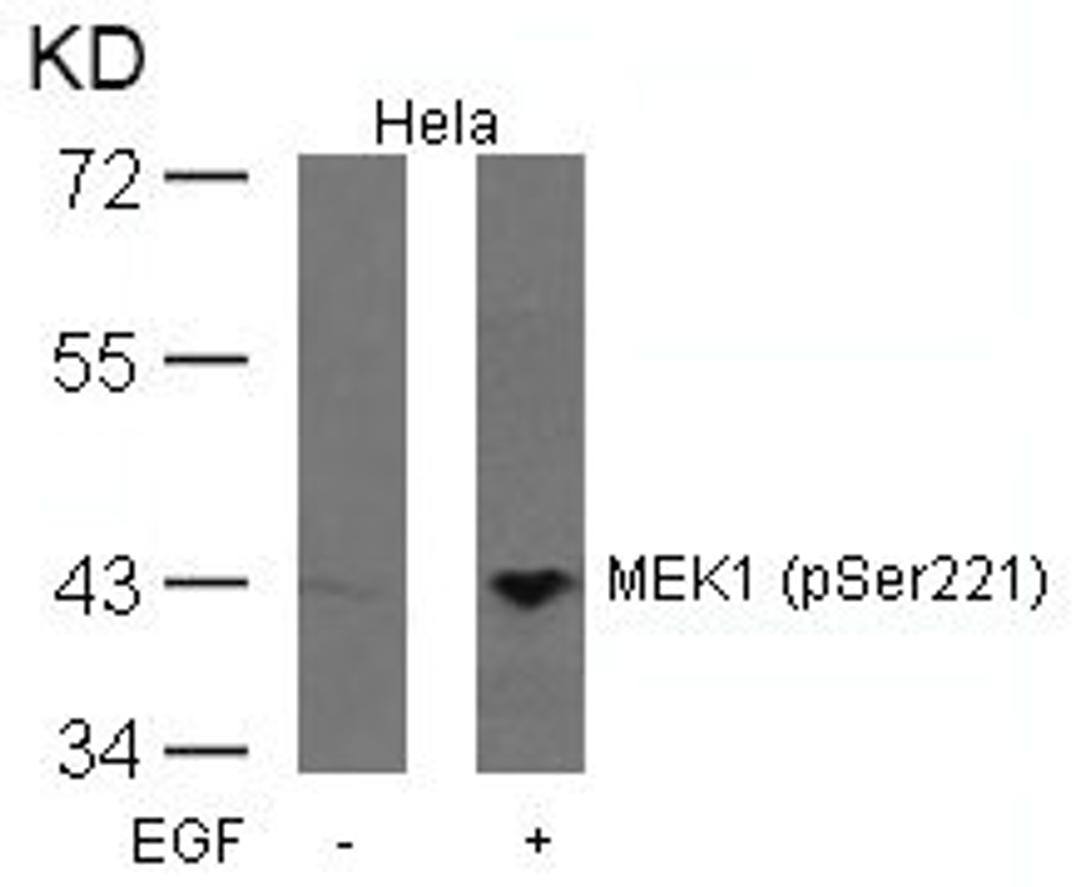 Western blot analysis of extracts from Hela cells untreated or treated with EGF using MEK1(Phospho-Ser221) Antibody.