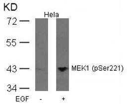 Western blot analysis of extracts from Hela cells untreated or treated with EGF using MEK1(Phospho-Ser221) Antibody.