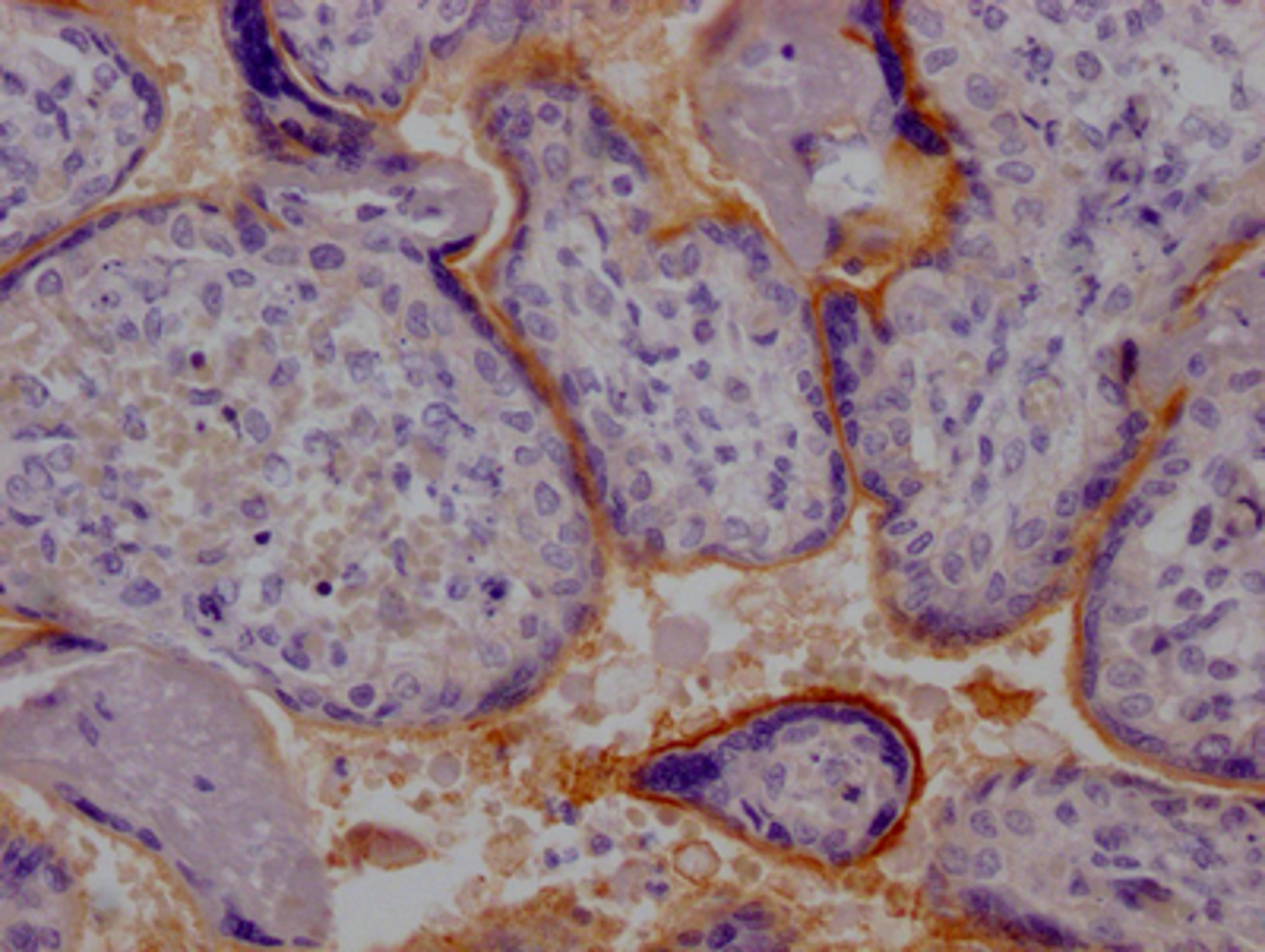 IHC image of CSB-RA669019A0HU diluted at 1:100 and staining in paraffin-embedded human placenta tissue performed on a Leica BondTM system. After dewaxing and hydration, antigen retrieval was mediated by high pressure in a citrate buffer (pH 6.0). Section was blocked with 10% normal goat serum 30min at RT. Then primary antibody (1% BSA) was incubated at 4℃ overnight. The primary is detected by a Goat anti-rabbit IgG polymer labeled by HRP and visualized using 0.05% DAB.