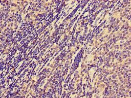 Immunohistochemistry of paraffin-embedded human lymph node tissue using CSB-PA015549LA01HU at dilution of 1:100