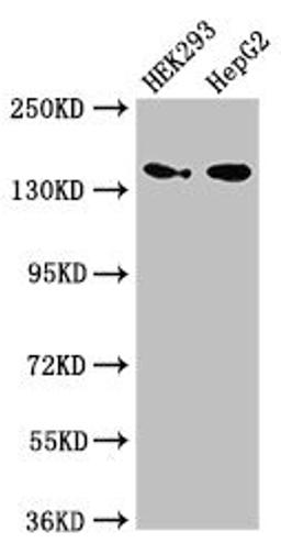Western Blot. Positive WB detected in: HEK293 whole cell lysate, HepG2 whole cell lysate. All lanes: MAN2A1 antibody at 3.5ug/ml. Secondary. Goat polyclonal to rabbit IgG at 1/50000 dilution. Predicted band size: 132 kDa. Observed band size: 150 kDa.