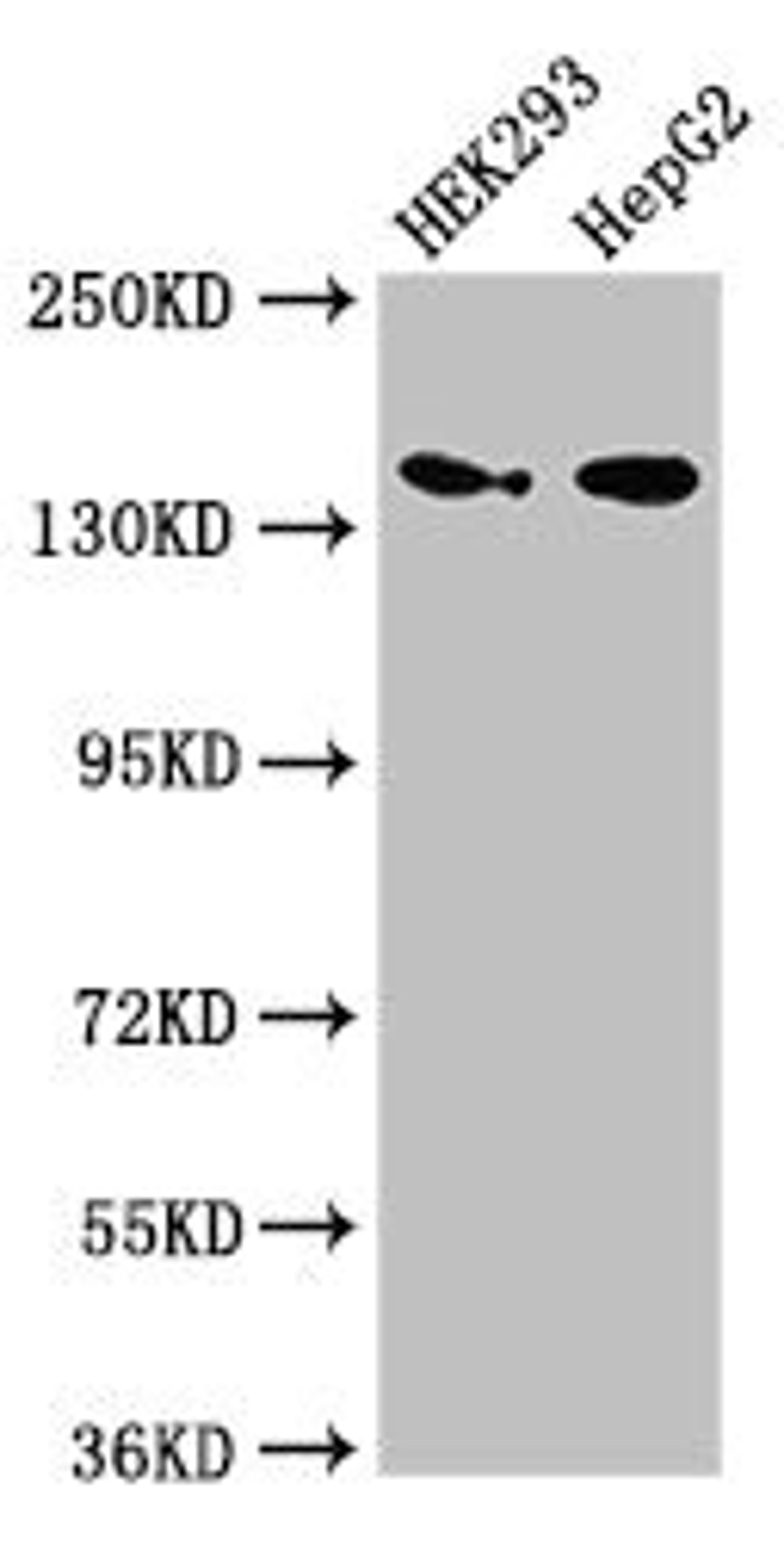 Western Blot. Positive WB detected in: HEK293 whole cell lysate, HepG2 whole cell lysate. All lanes: MAN2A1 antibody at 3.5ug/ml. Secondary. Goat polyclonal to rabbit IgG at 1/50000 dilution. Predicted band size: 132 kDa. Observed band size: 150 kDa.