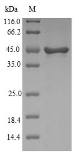 (Tris-Glycine gel) Discontinuous SDS-PAGE (reduced) with 5% enrichment gel and 15% separation gel.
