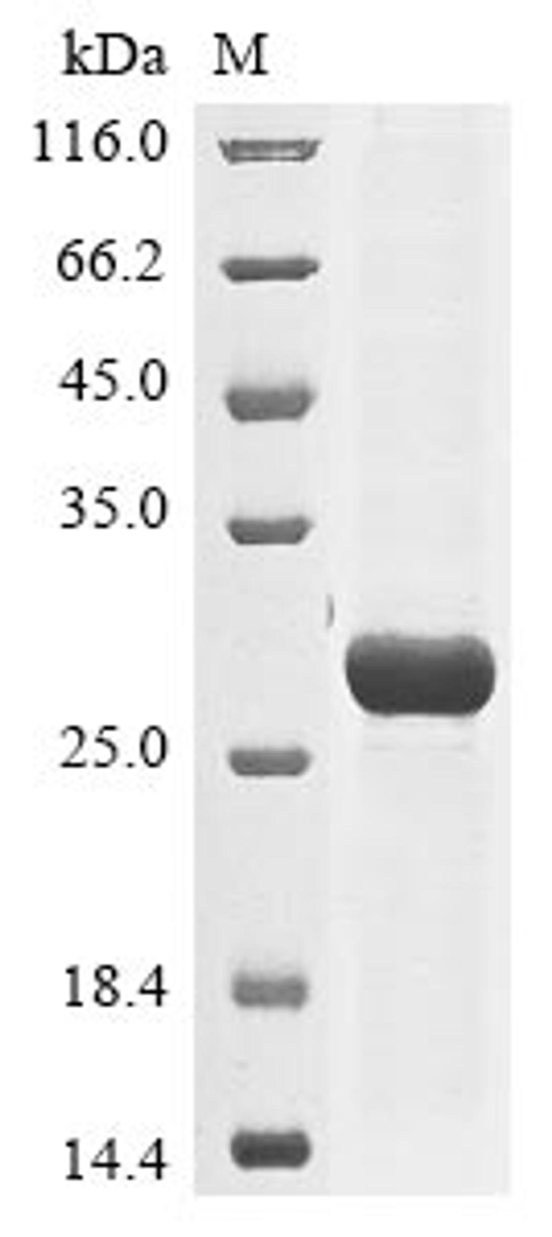 (Tris-Glycine gel) Discontinuous SDS-PAGE (reduced) with 5% enrichment gel and 15% separation gel.