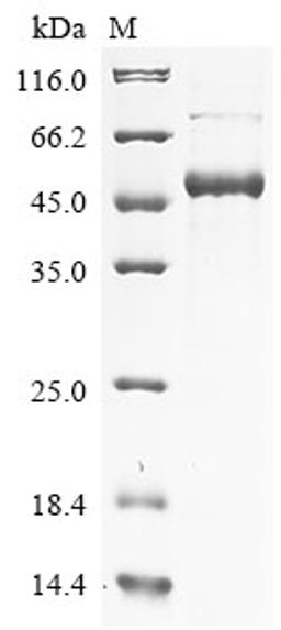 (Tris-Glycine gel) Discontinuous SDS-PAGE (reduced) with 5% enrichment gel and 15% separation gel.