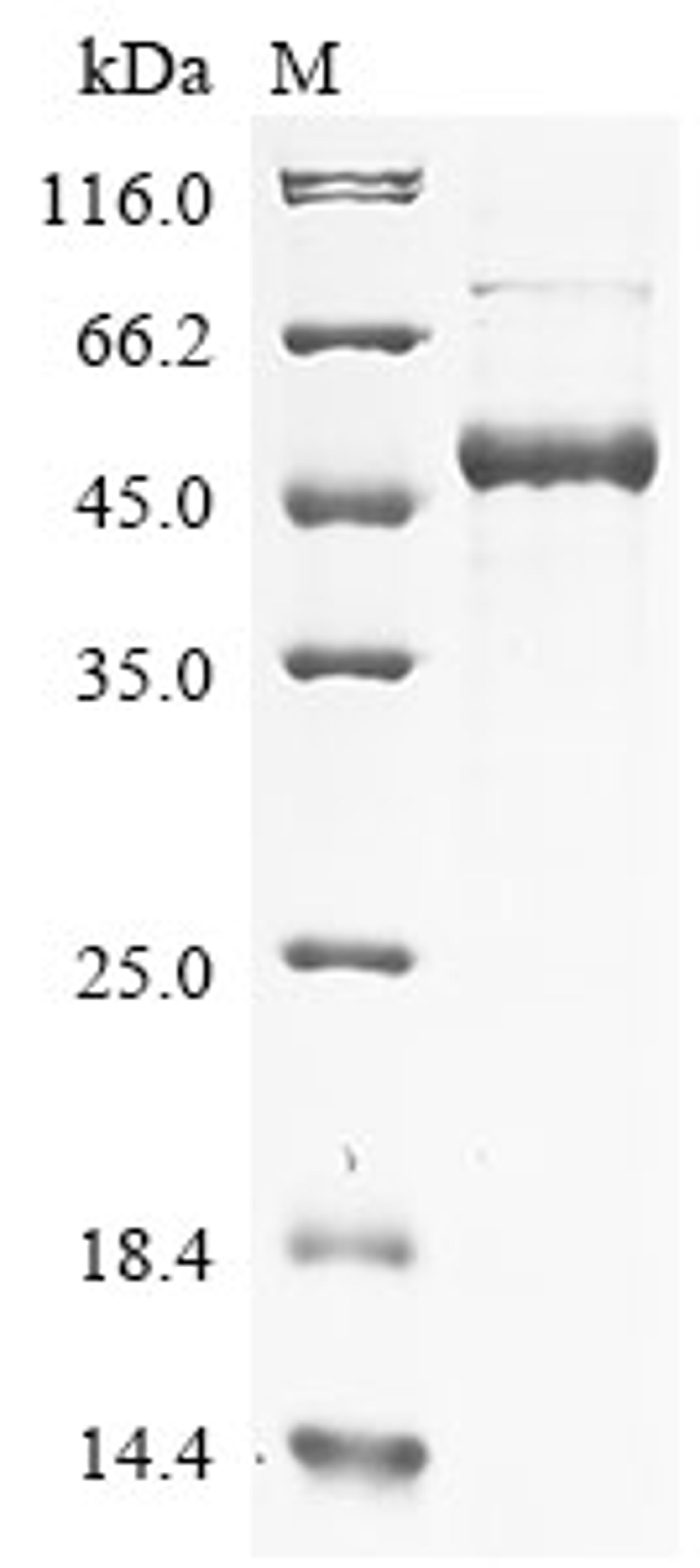 (Tris-Glycine gel) Discontinuous SDS-PAGE (reduced) with 5% enrichment gel and 15% separation gel.