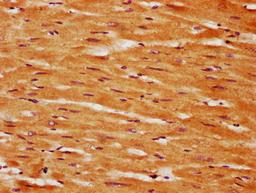 IHC image of CSB-PA861185LA01HU diluted at 1:350 and staining in paraffin-embedded human heart tissue performed on a Leica BondTM system. After dewaxing and hydration, antigen retrieval was mediated by high pressure in a citrate buffer (pH 6.0). Section was blocked with 10% normal goat serum 30min at RT. Then primary antibody (1% BSA) was incubated at 4&deg;C overnight. The primary is detected by a biotinylated secondary antibody and visualized using an HRP conjugated SP system.