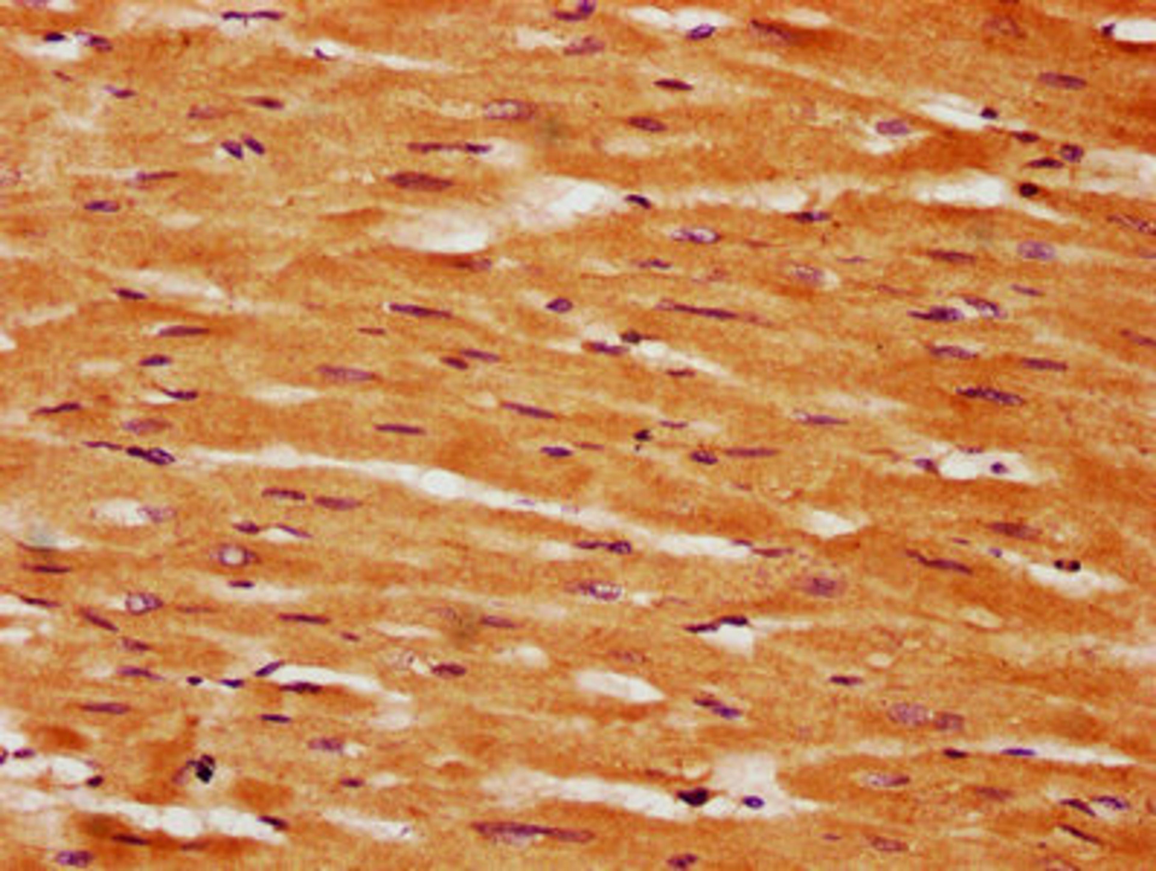 IHC image of CSB-PA861185LA01HU diluted at 1:350 and staining in paraffin-embedded human heart tissue performed on a Leica BondTM system. After dewaxing and hydration, antigen retrieval was mediated by high pressure in a citrate buffer (pH 6.0). Section was blocked with 10% normal goat serum 30min at RT. Then primary antibody (1% BSA) was incubated at 4°C overnight. The primary is detected by a biotinylated secondary antibody and visualized using an HRP conjugated SP system.