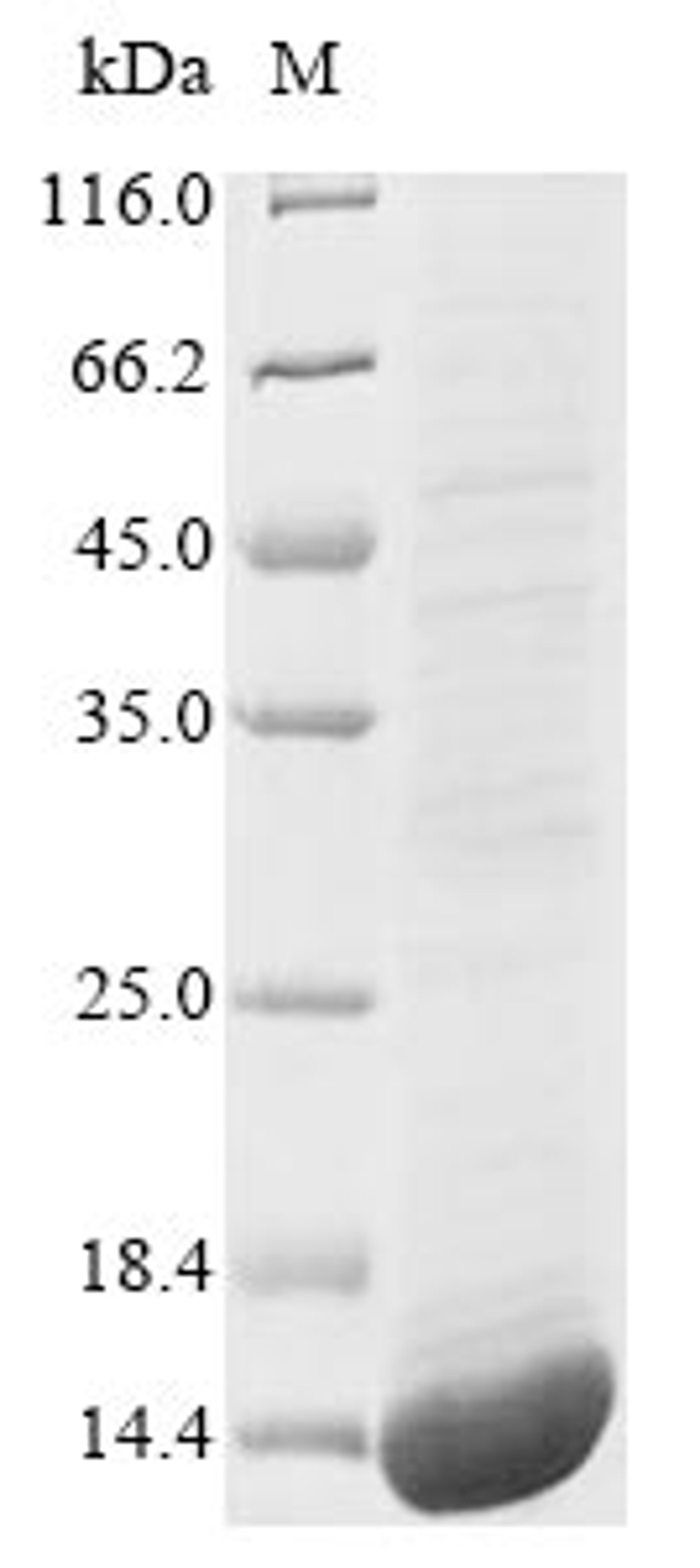 (Tris-Glycine gel) Discontinuous SDS-PAGE (reduced) with 5% enrichment gel and 15% separation gel.