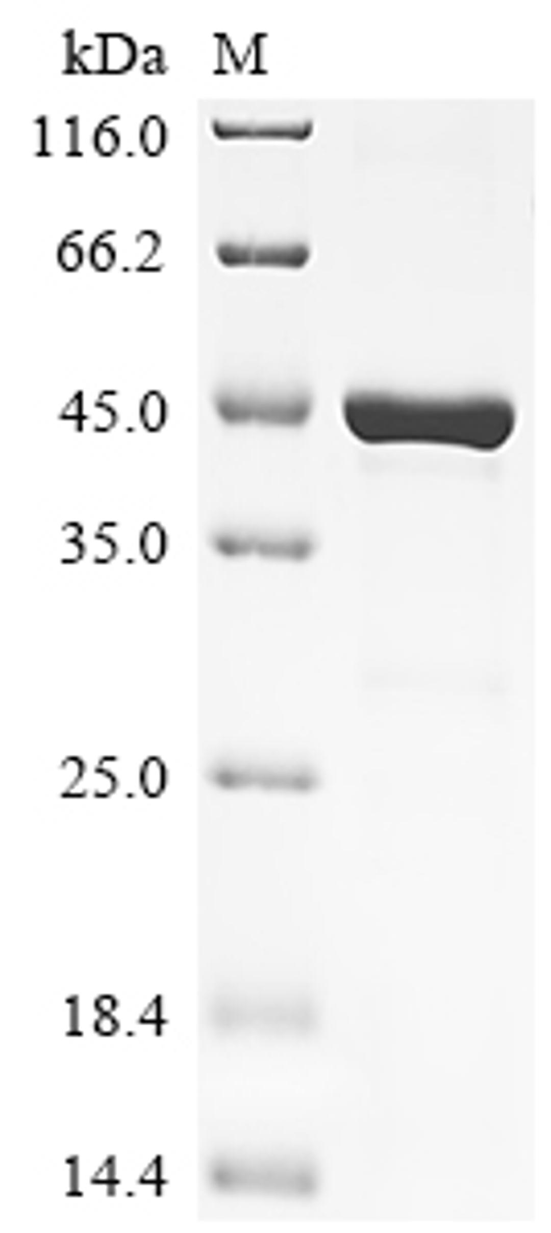 (Tris-Glycine gel) Discontinuous SDS-PAGE (reduced) with 5% enrichment gel and 15% separation gel.