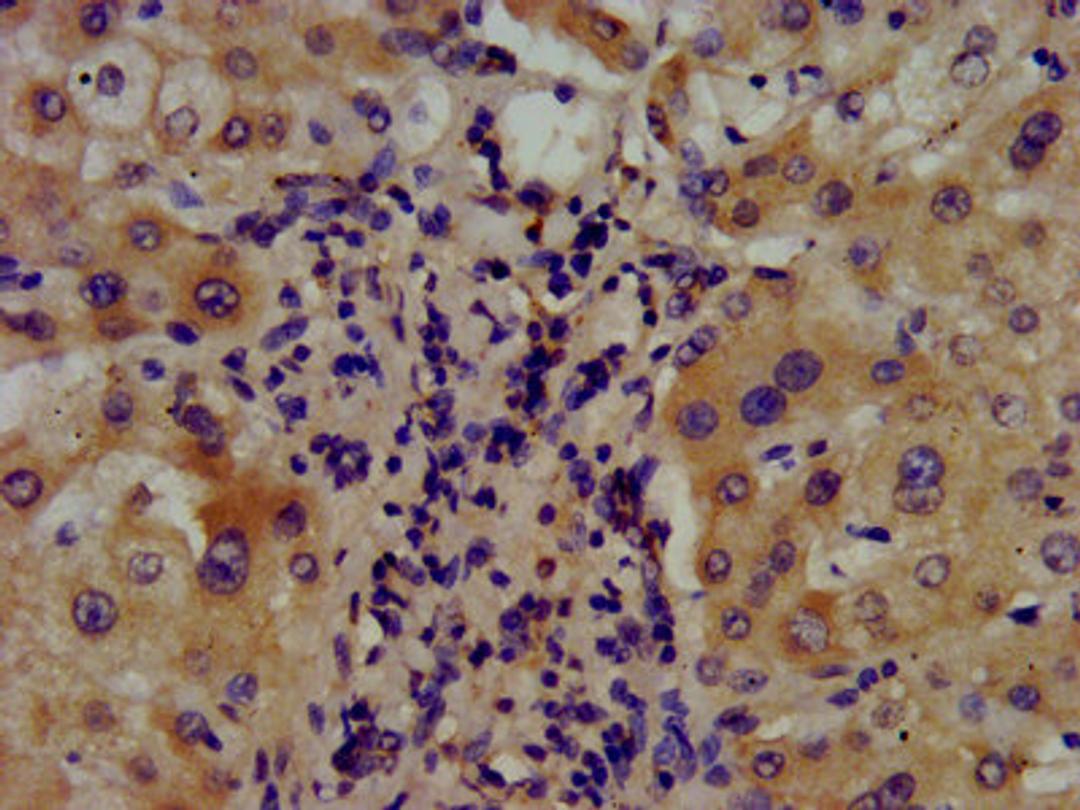 IHC image of CSB-PA002146LA01HU diluted at 1:400 and staining in paraffin-embedded human liver tissue performed on a Leica BondTM system. After dewaxing and hydration, antigen retrieval was mediated by high pressure in a citrate buffer (pH 6.0). Section was blocked with 10% normal goat serum 30min at RT. Then primary antibody (1% BSA) was incubated at 4&deg;C overnight. The primary is detected by a biotinylated secondary antibody and visualized using an HRP conjugated SP system.