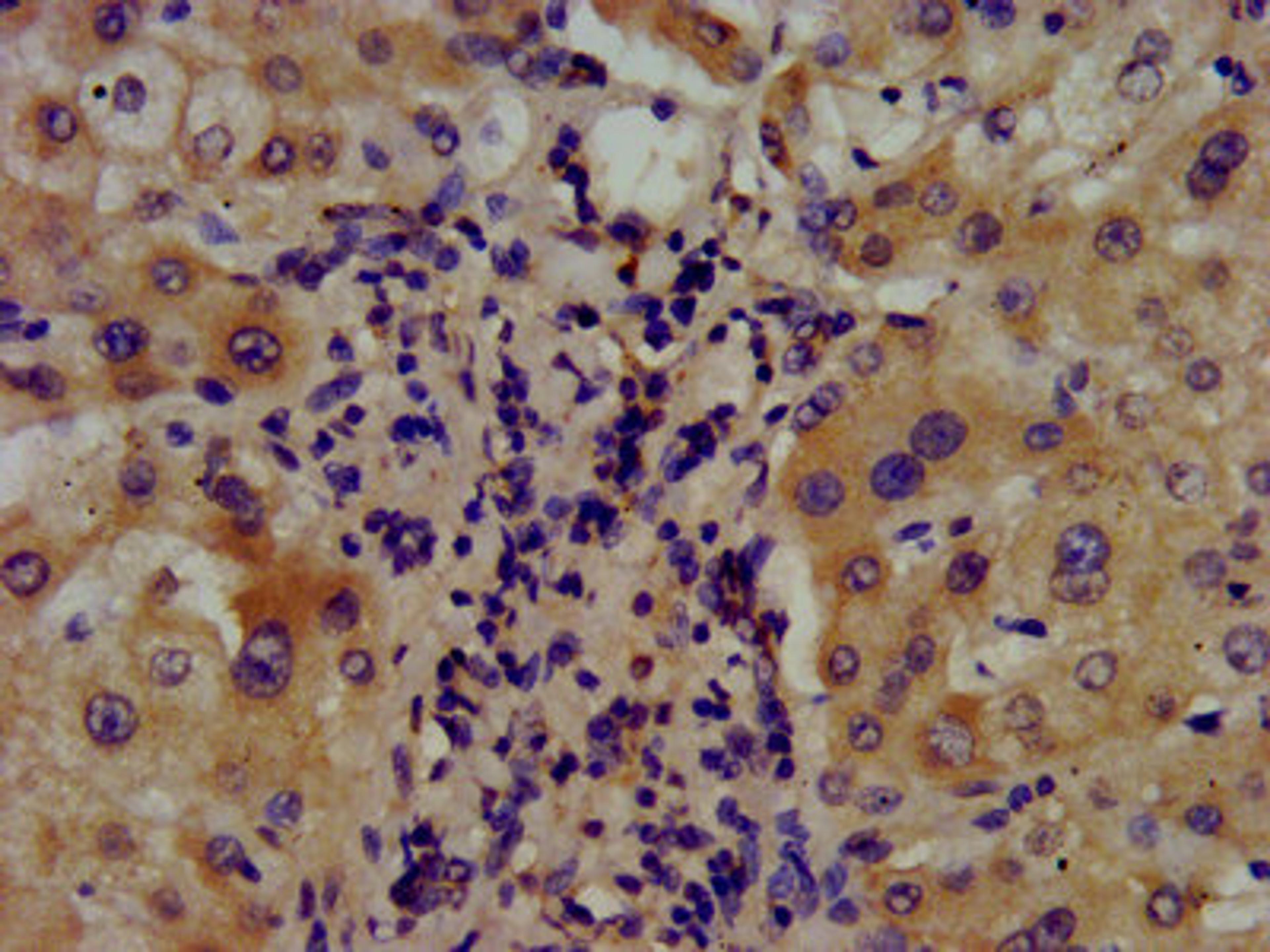 IHC image of CSB-PA002146LA01HU diluted at 1:400 and staining in paraffin-embedded human liver tissue performed on a Leica BondTM system. After dewaxing and hydration, antigen retrieval was mediated by high pressure in a citrate buffer (pH 6.0). Section was blocked with 10% normal goat serum 30min at RT. Then primary antibody (1% BSA) was incubated at 4&deg;C overnight. The primary is detected by a biotinylated secondary antibody and visualized using an HRP conjugated SP system.