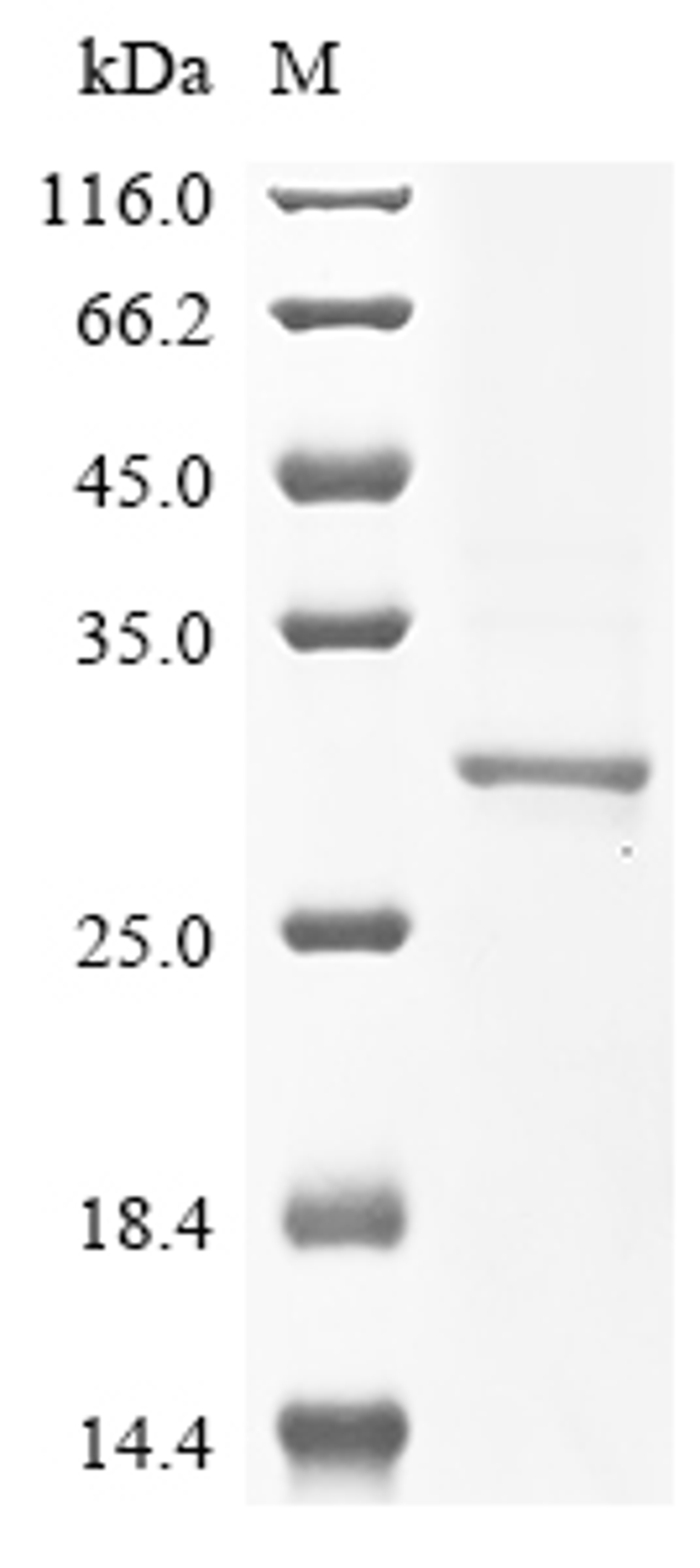 (Tris-Glycine gel) Discontinuous SDS-PAGE (reduced) with 5% enrichment gel and 15% separation gel.