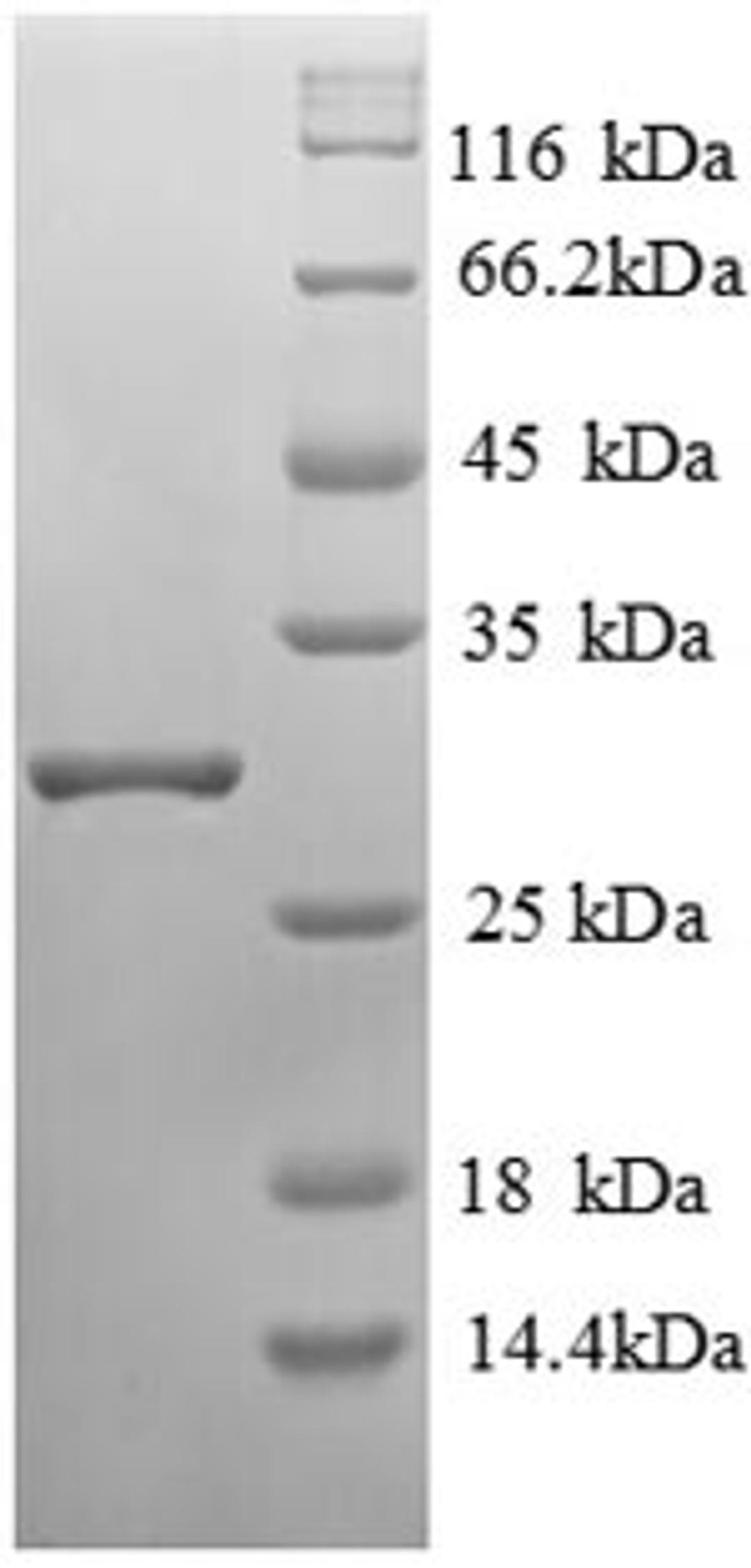 (Tris-Glycine gel) Discontinuous SDS-PAGE (reduced) with 5% enrichment gel and 15% separation gel.