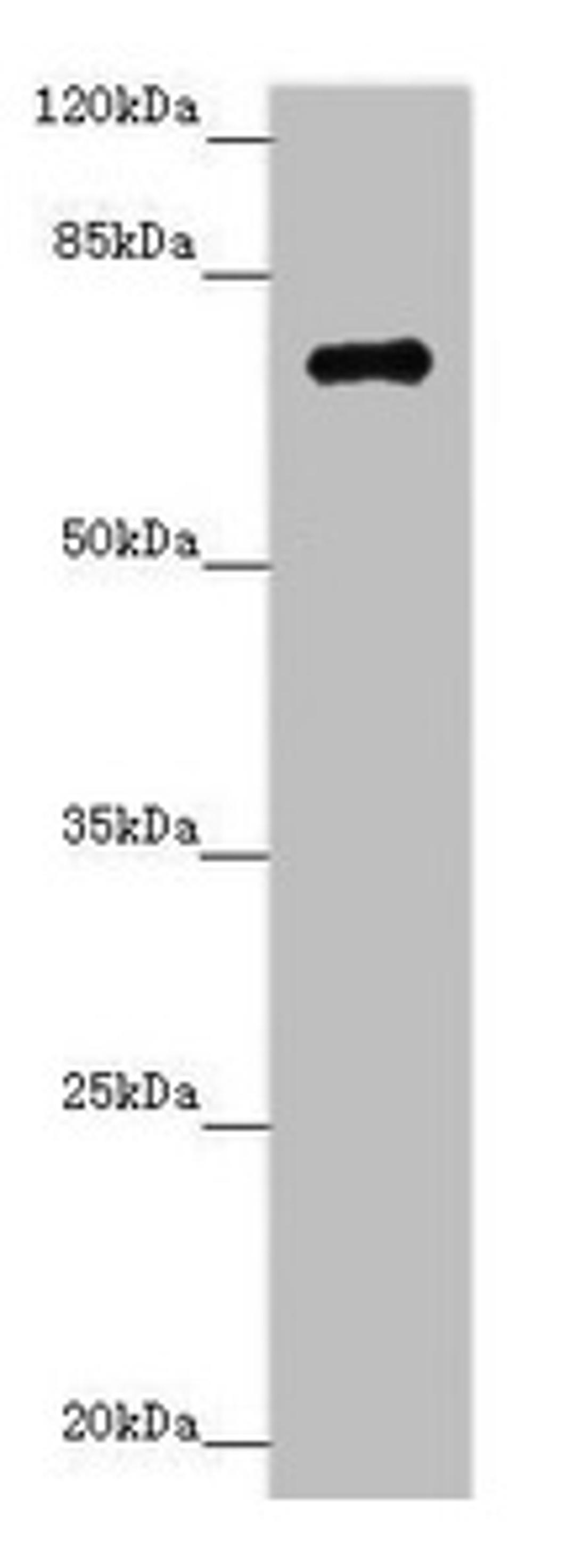Western blot. All lanes: ZNF264 antibody at 1.02µg/ml + Jurkat whole cell lysate. Secondary. Goat polyclonal to rabbit IgG at 1/10000 dilution. Predicted band size: 71 kDa. Observed band size: 71 kDa