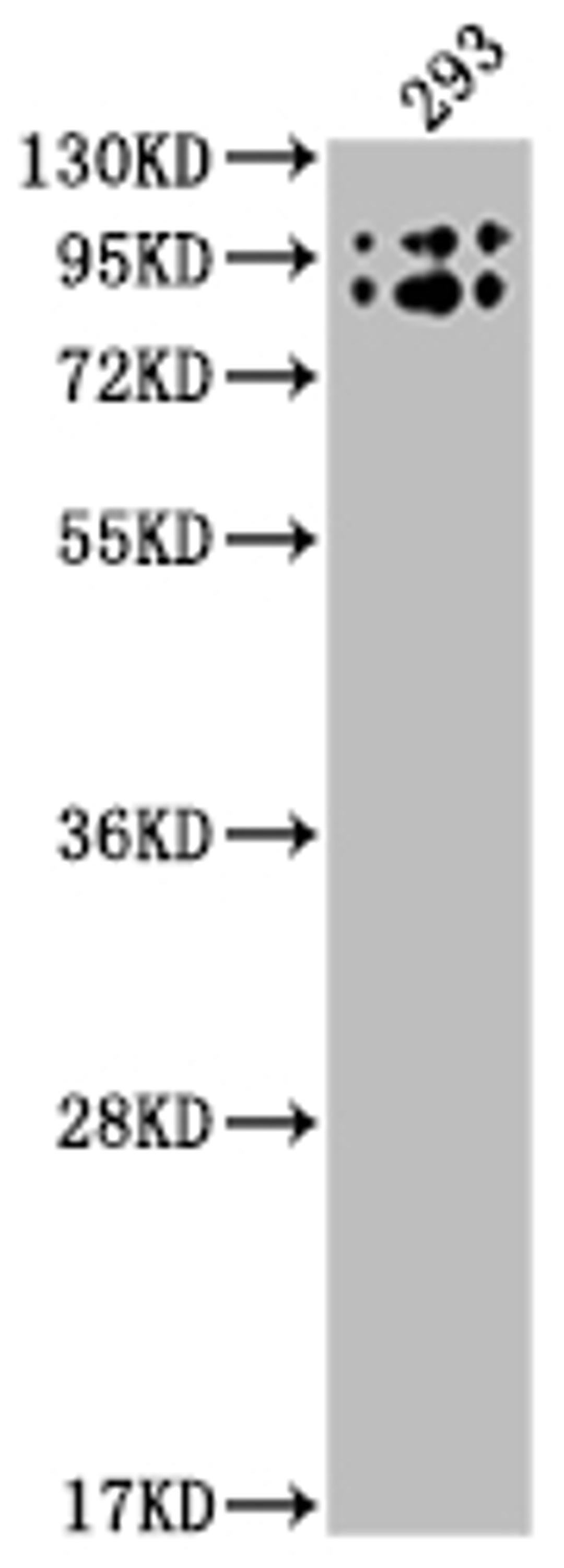 Western Blot. Positive WB detected in: 293 whole cell lysate. All lanes: BCHE antibody at 1:2000. Secondary. Goat polyclonal to rabbit IgG at 1/50000 dilution. Predicted band size: 69 kDa. Observed band size: 90 kDa. 