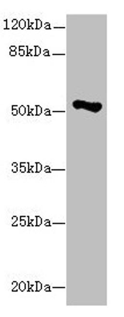 Western blot. All lanes: EIF2S3 antibody at 1.13µg/ml + Hela whole cell lysate. Secondary. Goat polyclonal to rabbit IgG at 1/10000 dilution. Predicted band size: 51 kDa. Observed band size: 51 kDa