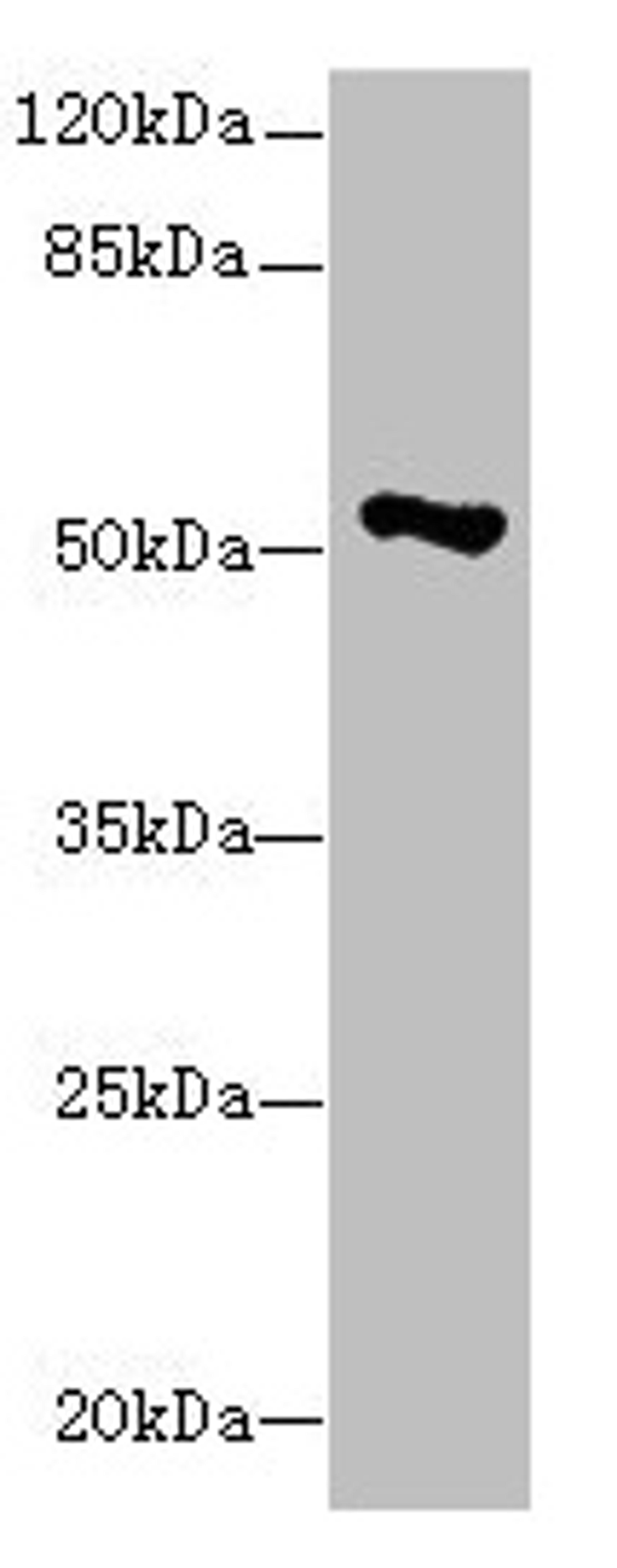 Western blot. All lanes: EIF2S3 antibody at 1.13µg/ml + Hela whole cell lysate. Secondary. Goat polyclonal to rabbit IgG at 1/10000 dilution. Predicted band size: 51 kDa. Observed band size: 51 kDa