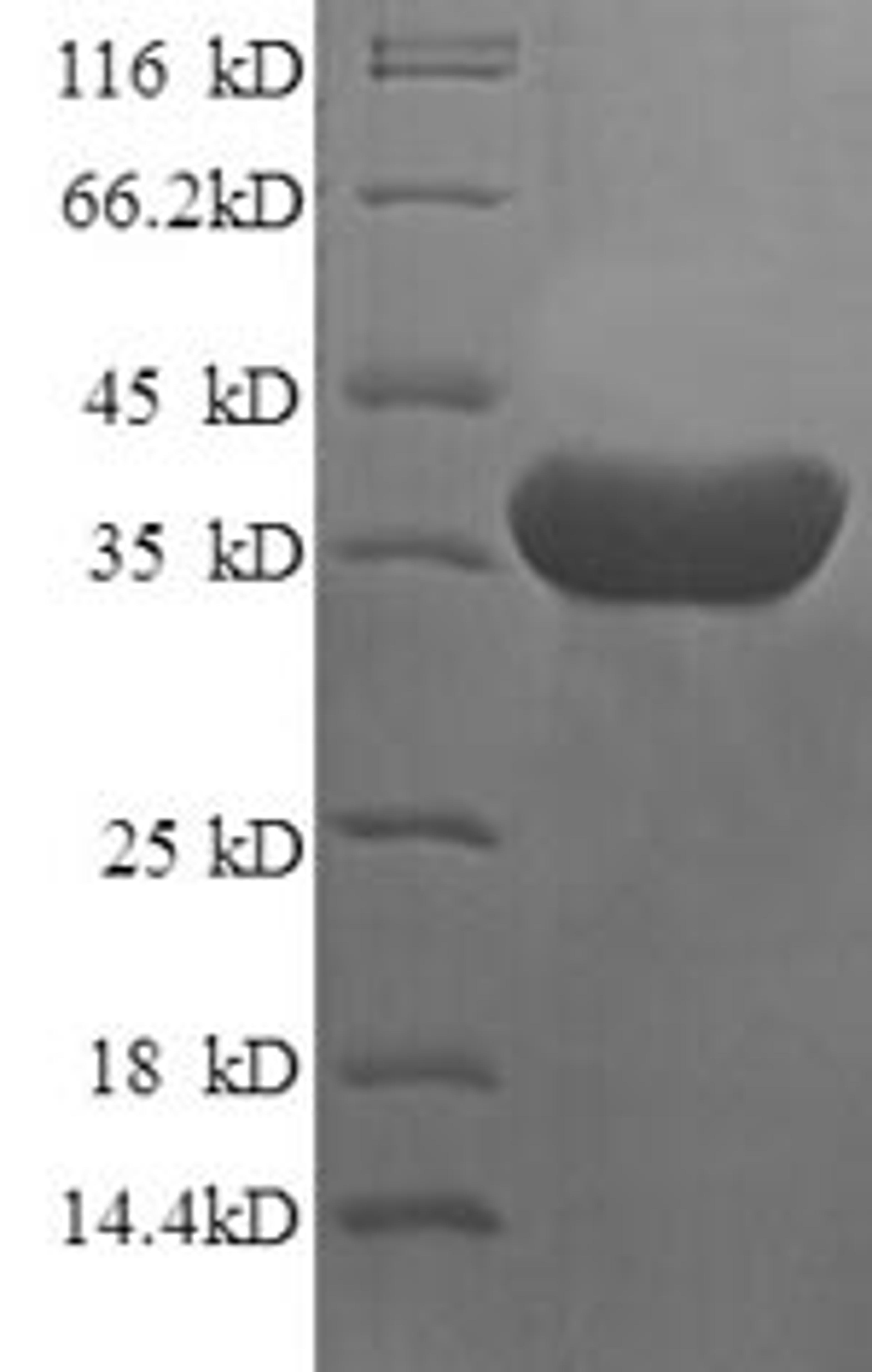(Tris-Glycine gel) Discontinuous SDS-PAGE (reduced) with 5% enrichment gel and 15% separation gel.
