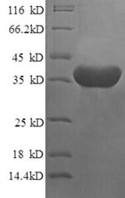 (Tris-Glycine gel) Discontinuous SDS-PAGE (reduced) with 5% enrichment gel and 15% separation gel.