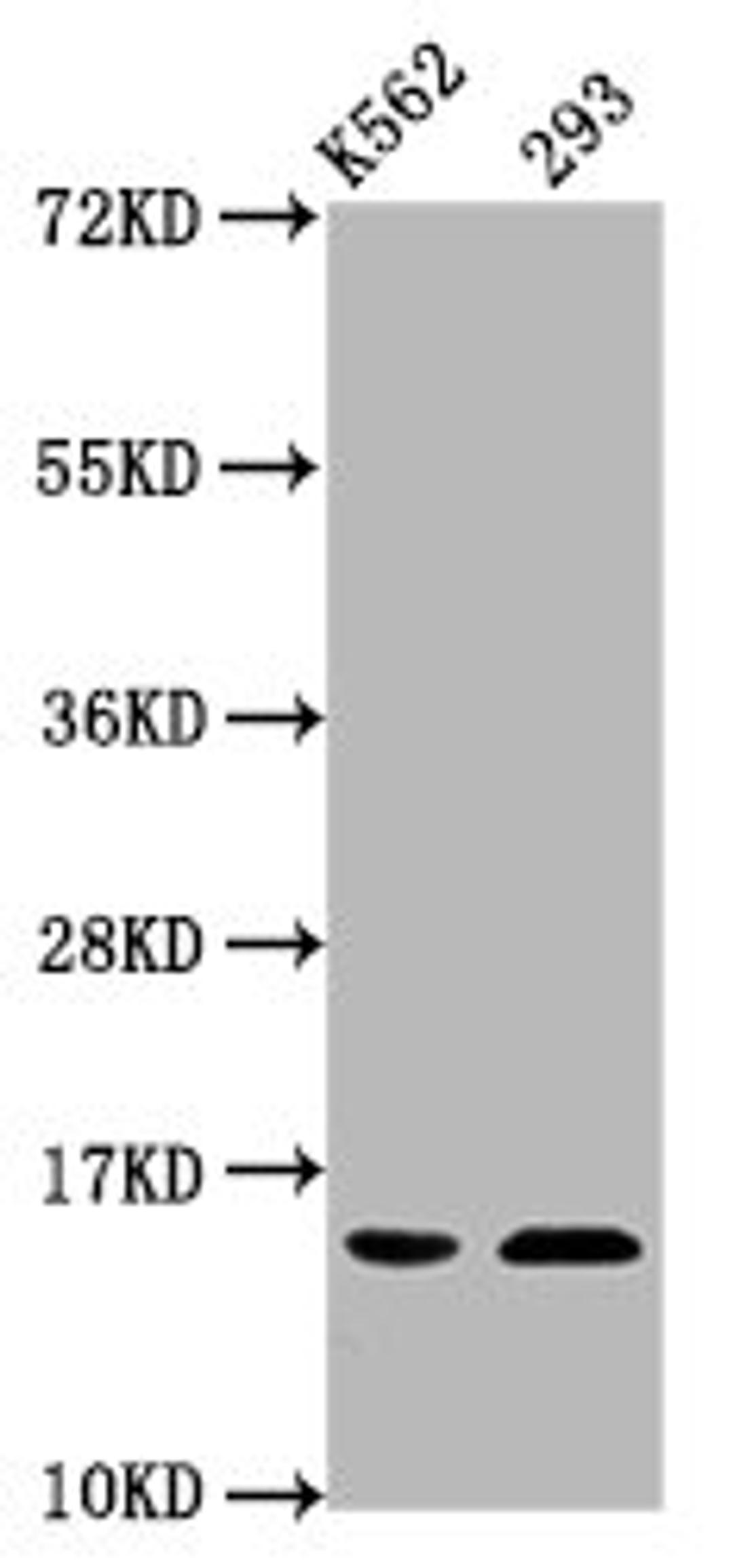 Western Blot. Positive WB detected in: K562 whole cell lysate, 293 whole cell lysate. All lanes: HIST1H2BC antibody at 0.32µg/ml. Secondary. Goat polyclonal to rabbit IgG at 1/50000 dilution. Predicted band size: 14 kDa. Observed band size: 14 kDa